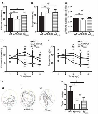 Enhanced Autolysosomal Function Ameliorates the Inflammatory Response Mediated by the NLRP3 Inflammasome in Alzheimer’s Disease
